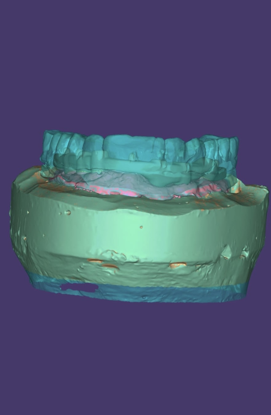 Digital dentistry workflow